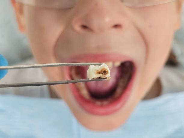 Best Emergency Gum Pain Relief  in Vass, NC